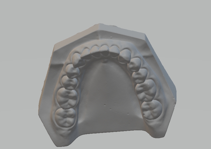 dental modelo 3D print model - Mito3D