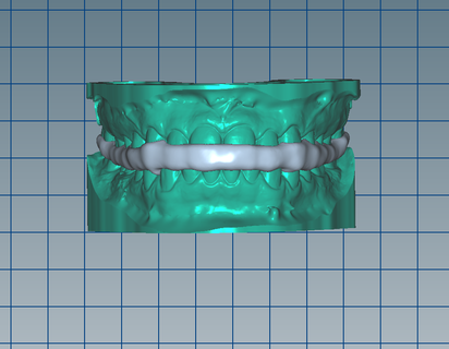 dental modelo placa mordida + articulador base customizada 2023 stl videogames zocalada arte impressionar 3d resina impressão dentes 3d print model - Mito3D