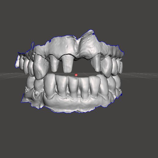 dental model case exocad cad practice 1 scan inlab 3shape dentistry 3D print model - Mito3D