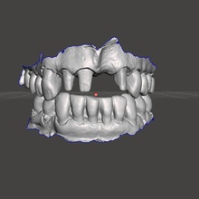 dentale modello Astuccio guaina exocad cad pratica 1 scansione inlab 3shape odontoiatria 3d print model - Mito3D
