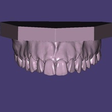 Dental Modell demonstrativ Zahn Zähne dental3d cad 3dprint 3d Zahnarzt Techniker 3d print model - Mito3D