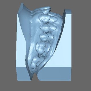 dental modelo dente dentes dental3d cafajeste 3dprint 3d dentista técnico 3d print model - Mito3D