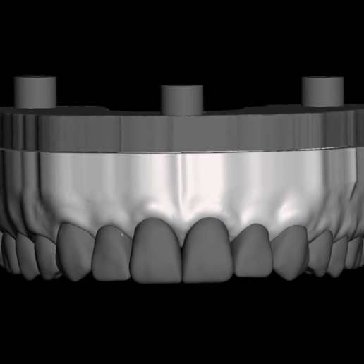 dental modelo desmontable dientes varios 3D print model - Mito3D