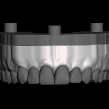 dental modello staccabile denti vari 3d print model - Mito3D