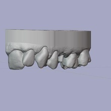 dental model die arch b4d tooth teeth dental3d cad 3dprint 3d dentist technician 3d print model - Mito3D