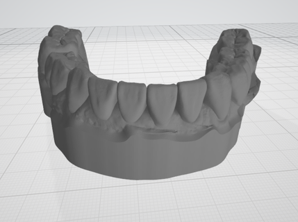 Dental Modell niedriger Kiefer Wachs verschiedene Oberer höher up Zahn Delle exocad 3d print model - Mito3D