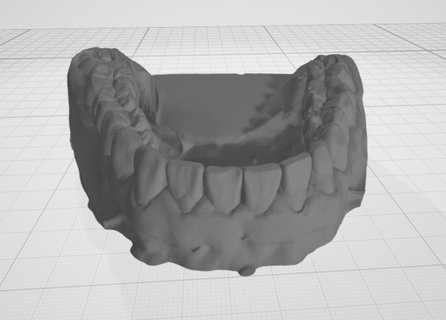dentaire modèle inférieur mâchoire cire up dent bosse exocad 3d print model - Mito3D
