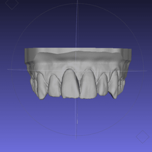 dental model mouth teeth 3d print model - Mito3D