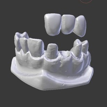 dental modello di protesi vari 3d La stampa dente 3d print model - Mito3D