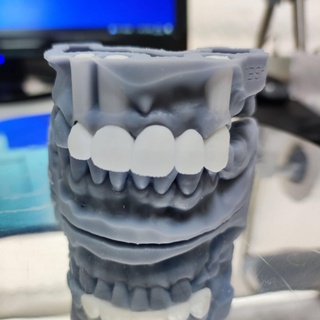 dentaire modèle amovible pont modèles résine prothétique dentisterie éducation recherche développement prothésistes couronnes ponts 3d print model - Mito3D