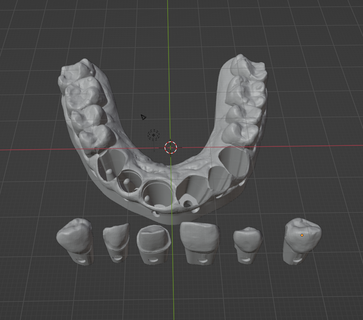 dental model removable dies Various upper jaw wax up tooth teet dentst exocad 3d print model - Mito3D