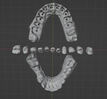 dental modelo retirable muere Superior mandíbula cera up diente tú mella exocad 3d print model - Mito3D