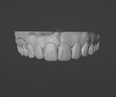 dental model upper jaw - wax Various dental model upper jaw wax up tooth teet dentst exocad  3d print model - Mito3D