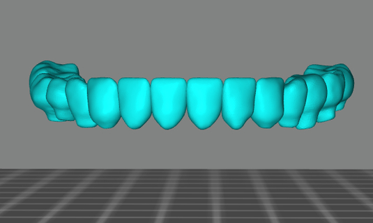 dental models - upper stl files 3d print model - Mito3D