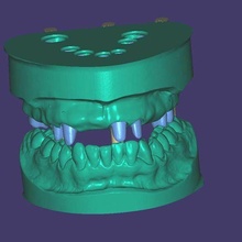 dental modelos articulador diente dientes modelo dental3d canalla 3dprint 3d dentista técnico 3d print model - Mito3D