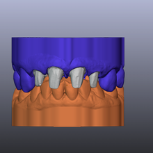 dental modelos muere bisagra articulador b4d diente dientes modelo dental3d canalla 3dprint 3d dentista técnico ortodoncia 3d print model - Mito3D