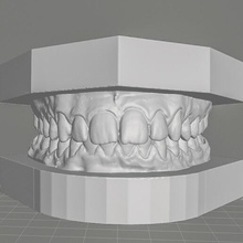 dental orthodontic study model bases dental tooth teeth model dental3d cad 3dprint 3d dentist dental technician orthodontic