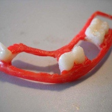 dental parcial dentadura postiza cosa 3d print model - Mito3D