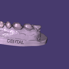 diş baskı modeller 3 3d print model - Mito3D