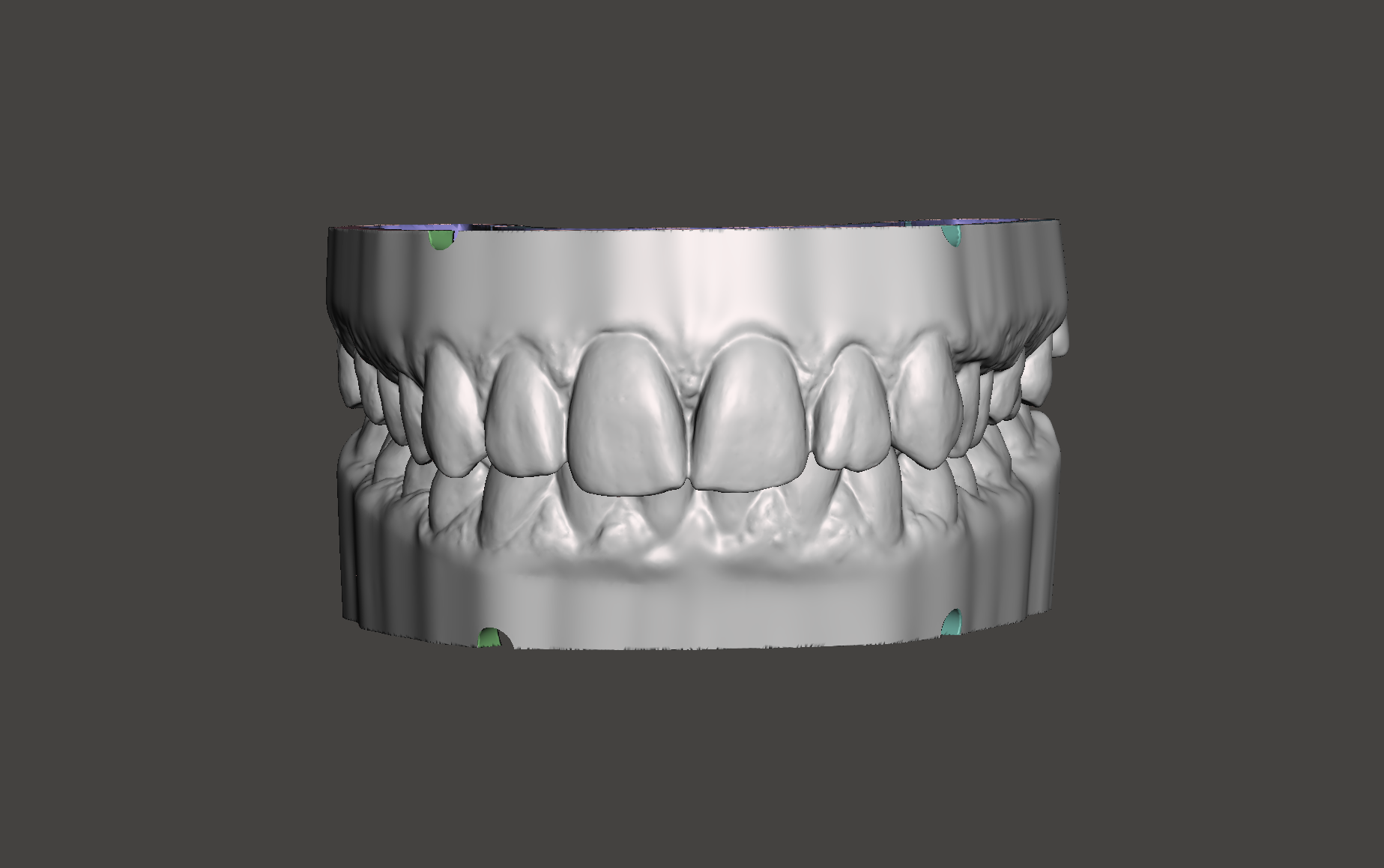 dentaire étude modèles dentisterie dents bouche conception 3D print model - Mito3D