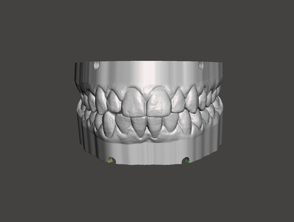 dental study models 3d print model - Mito3D