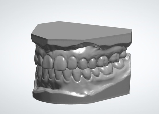 dental estudiar modelos dentista diente dientes modelo anatomía 3d print model - Mito3D