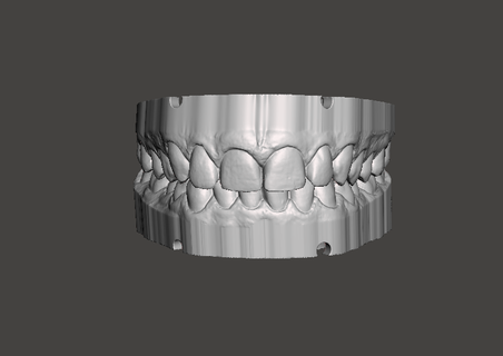 dental estude modelos arte odontologia dentes boca Projeto 3d print model - Mito3D