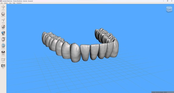 dientes hombre burbuja acorta exocad mezclador malla 3d print model - Mito3D
