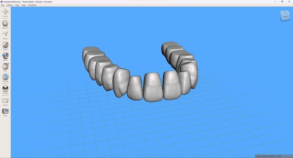 dentes maxila - ashortia exocad teeth meshmixer 3d print model - Mito3D