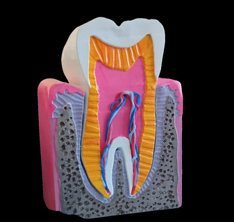 dentin pulp Komplex Attrappe Lehrmodell Simulation 3d print model - Mito3D