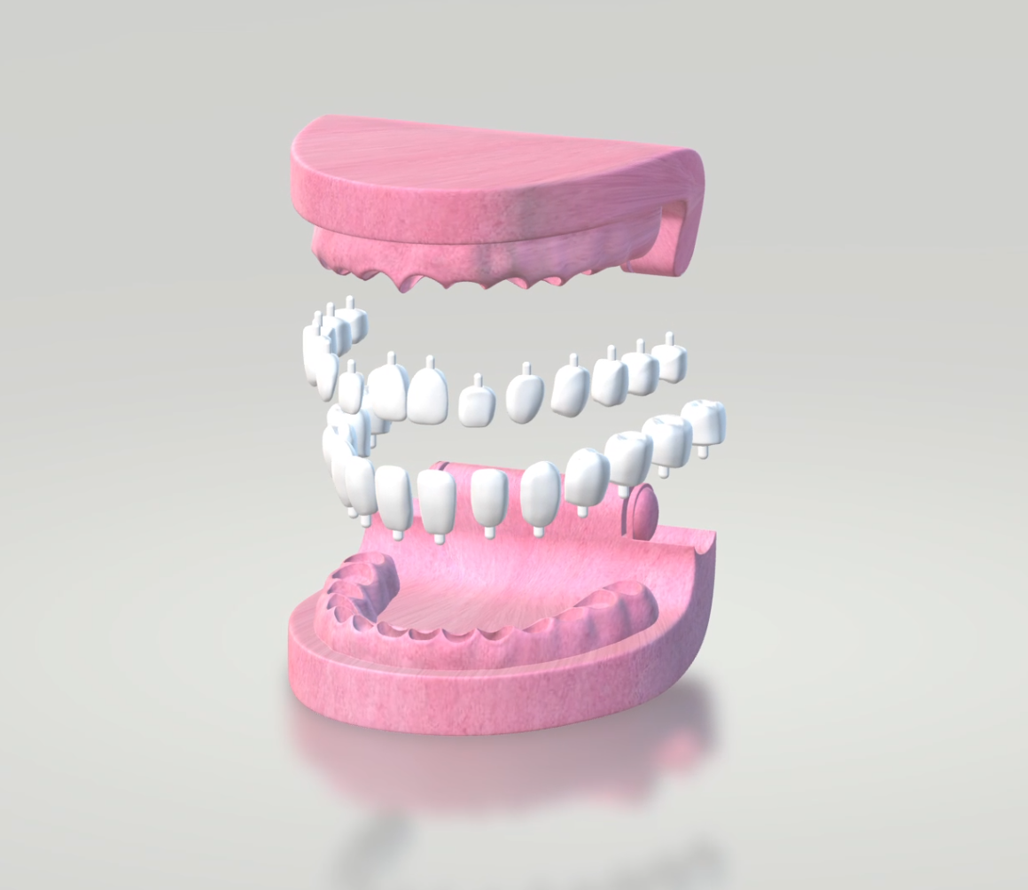 dentadura dental prótesis dientes diente goma dentista modelo desmontable 3D print model - Mito3D