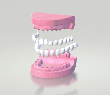 dentier dentaire prothèse dents dent gencive dentiste modèle démontable 3d print model - Mito3D