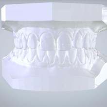 digitale abo pianificazione dei modelli di studio vari cnc ortodontico keyshot 3shape cad Stampante 3d dentale 3d print model - Mito3D