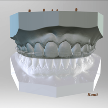 dijital bite-guard cihazı çeşitli diş teknolojisi dental cad ısırık reçine sl1 orijinal prusa 3d yazıcılar uyku tıbbi cihaz keyshotpro 3shape 3d print model - Mito3D