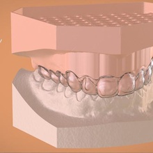 digital bleaching tray various dental cad tooth white 3d printing 3shape keyshot 3d print model - Mito3D