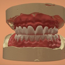 digital complete dentures various tooth 3shape 3d printing cad keyshot dental 3d print model - Mito3D