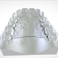 numérique cranham deprogrammer various orthodontics dental cad 3d printer 3shape appliance splint medical teeth keyshot 3d print model - Mito3D