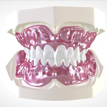 dijital tam protez dişler manuel azaltma gluedin çeşitli diş hekimliği labmagic 3d cad keyshot pro 3shape baskı 3d print model - Mito3D