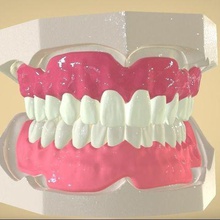 digitale Vollprothesen verschiedene dental 3d drucken 3d print model - Mito3D