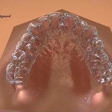 digital kois styled nightguard various dental 3d printing cad rami medical splint orthodontic appliances 3d print model - Mito3D