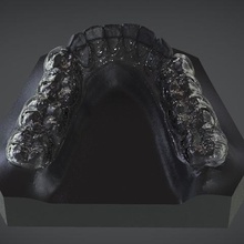 digital mandibular descompressão tala vários ortodontia dentisteria Cad 3d Impressoras digitalizados modelos 3shape aparelho labmagic cad 3d print model - Mito3D