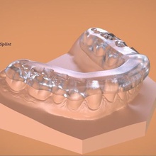 digital mandibular tanner férula varios dental la ortodoncia mordedura de 3shape keyshot pro 3d render realista cad Las impresoras cadcam labmagic en 3d print model - Mito3D