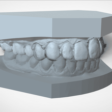 digital ortho mini deprogrammer splint various cult3d medical orthodontics sleep device labmagic3dcad rami keyshot 3shape cnc 3d print cam cad 3d print model - Mito3D