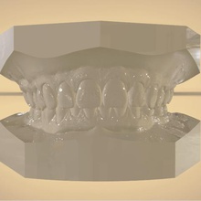 digital orthodontic study models virtual bases various dental 3shape cad 3d scanning printer 3d print model - Mito3D