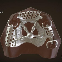 digital removable partial denture framework various dental 3d printing medical tooth 3shape keyshot 3d print model - Mito3D