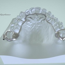 digital rick-a-nator appliance various dental orthodontics appliances splints 3shape tooth medical keyshot pro 3d print model - Mito3D