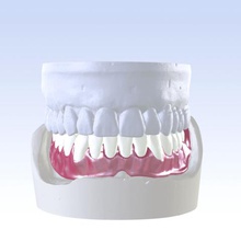 unico digitale mandibola protesi totale vari dente sorriso medico 3shape cam cad roland dwx-50 fresatura cnc 3d dentale 3d print model - Mito3D