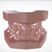digital studio ortodontico archman modello vari dentcal 3d 3shape cad ortodonzia medico La stampa 3d print model - Mito3D