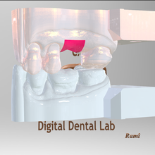 Digital ti base Widerlager Modell Dental 3shape exocad Tibase CAD CAM medizinisch 3d Drucken 3d print model - Mito3D