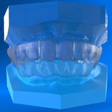 dijital konumlandırıcı 3d baskı diş çeşitli uyku tıp cad 3shape splint protez 3d print model - Mito3D